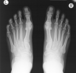 Digital copy of X-ray